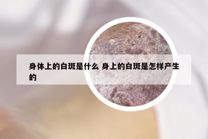 身体上的白斑是什么 身上的白斑是怎样产生的