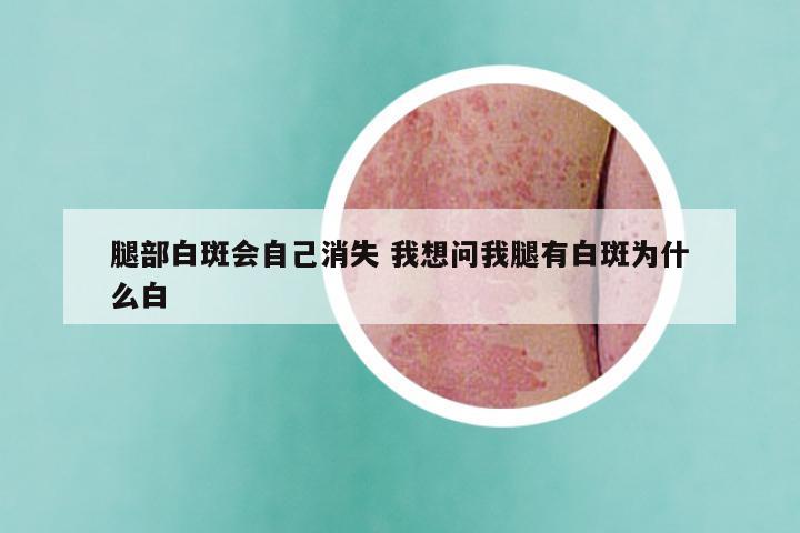 腿部白斑会自己消失 我想问我腿有白斑为什么白