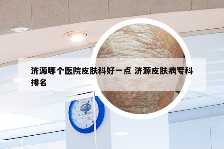 济源哪个医院皮肤科好一点 济源皮肤病专科排名