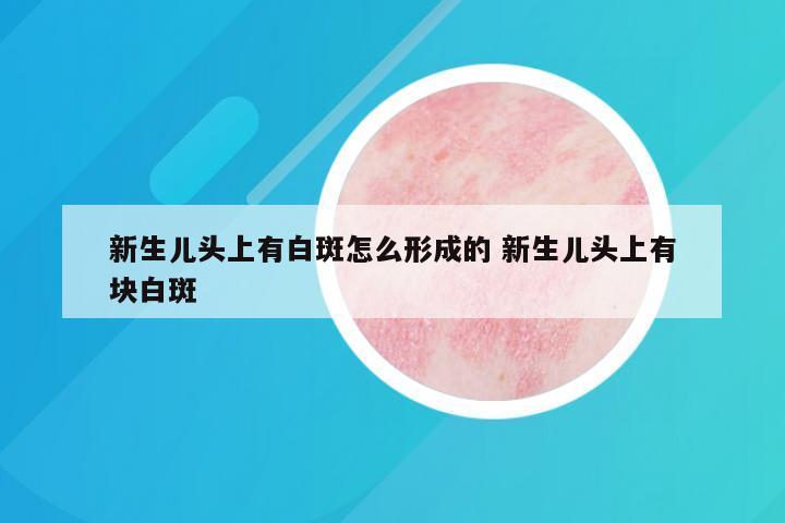 新生儿头上有白斑怎么形成的 新生儿头上有块白斑