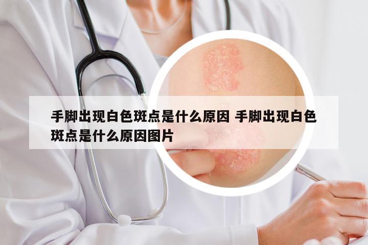 手脚出现白色斑点是什么原因 手脚出现白色斑点是什么原因图片