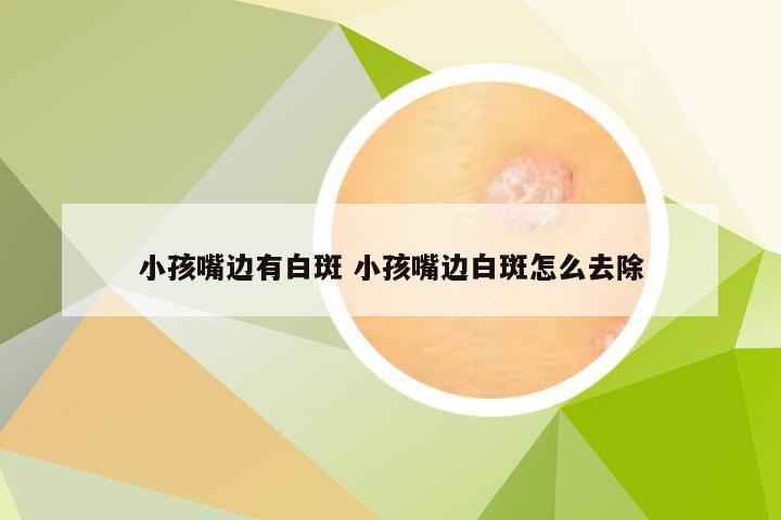 小孩嘴边有白斑 小孩嘴边白斑怎么去除