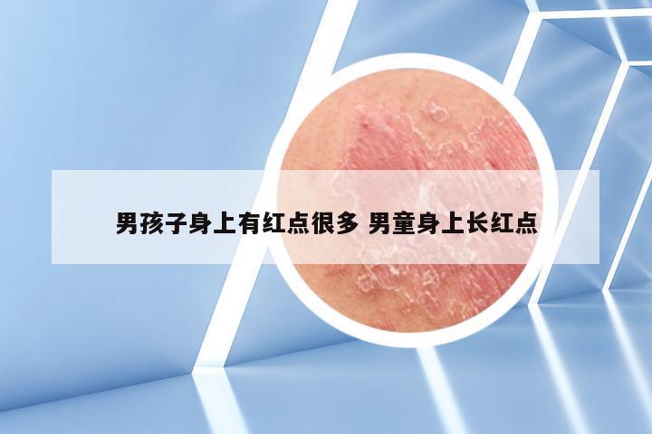 男孩子身上有红点很多 男童身上长红点