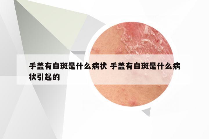 手盖有白斑是什么病状 手盖有白斑是什么病状引起的