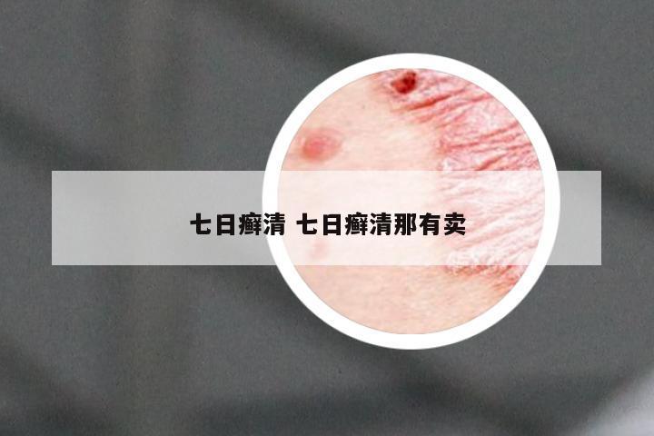 七日癣清 七日癣清那有卖
