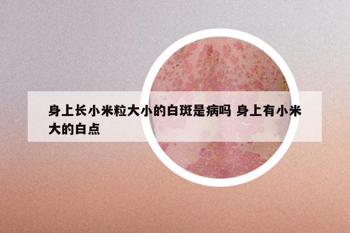 身上长小米粒大小的白斑是病吗 身上有小米大的白点