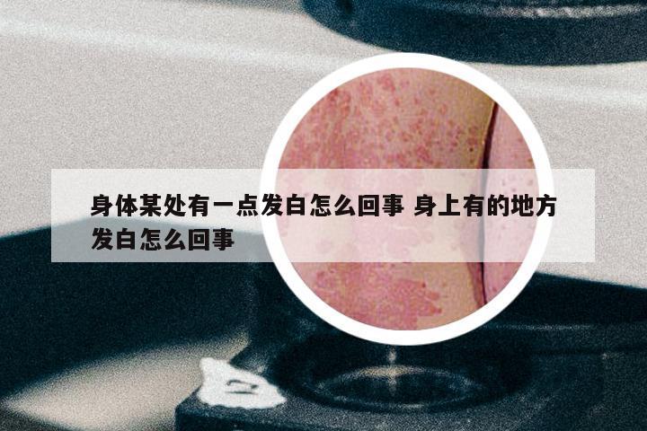 身体某处有一点发白怎么回事 身上有的地方发白怎么回事