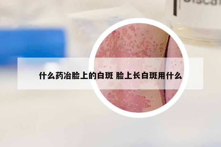 什么药冶脸上的白斑 脸上长白斑用什么