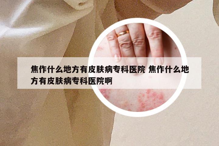 焦作什么地方有皮肤病专科医院 焦作什么地方有皮肤病专科医院啊