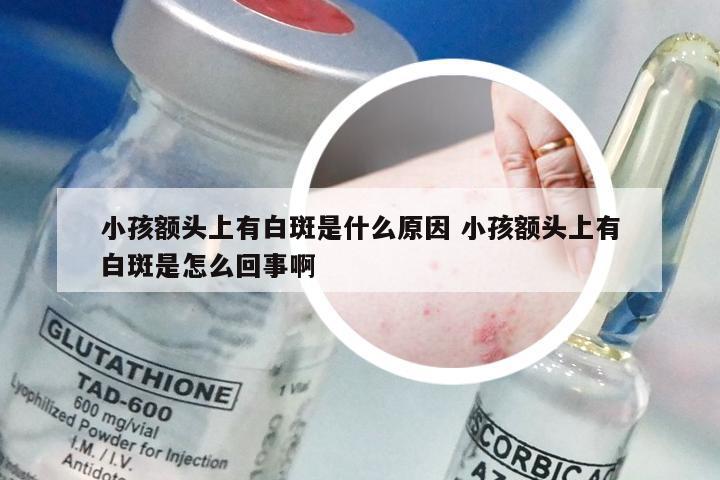 小孩额头上有白斑是什么原因 小孩额头上有白斑是怎么回事啊