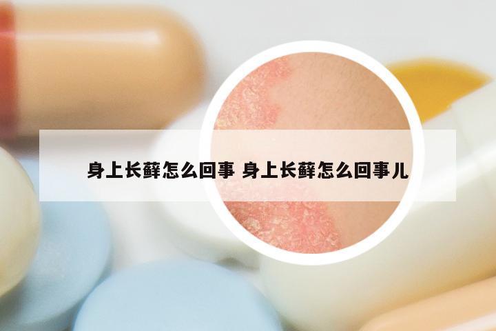 身上长藓怎么回事 身上长藓怎么回事儿