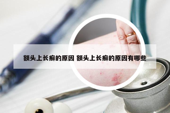 额头上长癣的原因 额头上长癣的原因有哪些