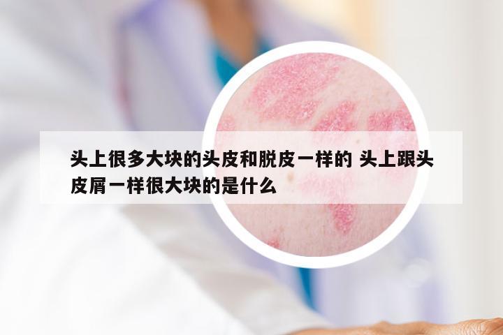 头上很多大块的头皮和脱皮一样的 头上跟头皮屑一样很大块的是什么