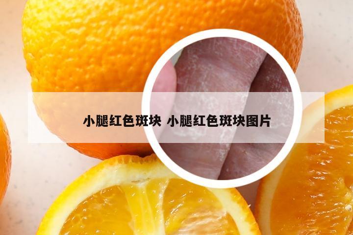 小腿红色斑块 小腿红色斑块图片