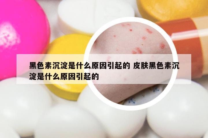 黑色素沉淀是什么原因引起的 皮肤黑色素沉淀是什么原因引起的