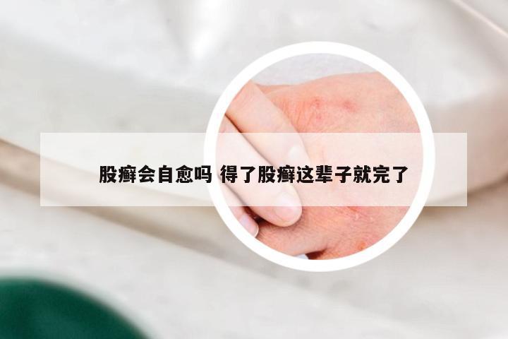 股癣会自愈吗 得了股癣这辈子就完了