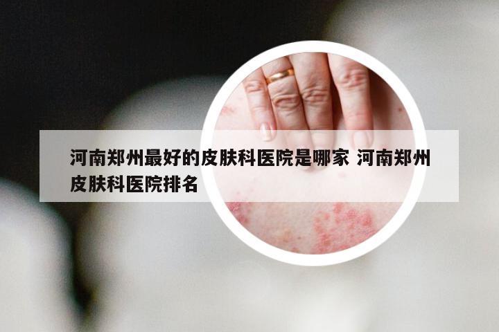河南郑州最好的皮肤科医院是哪家 河南郑州皮肤科医院排名