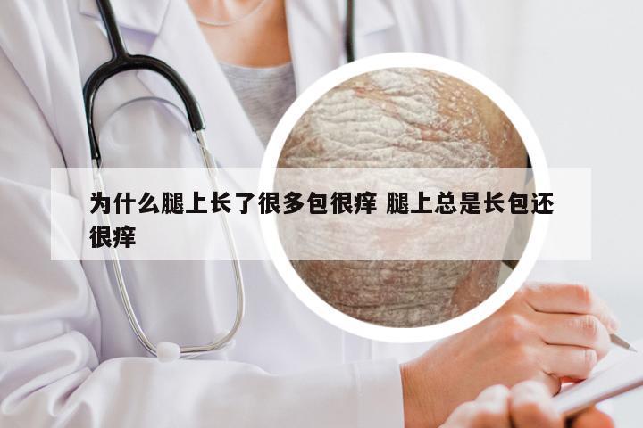 为什么腿上长了很多包很痒 腿上总是长包还很痒