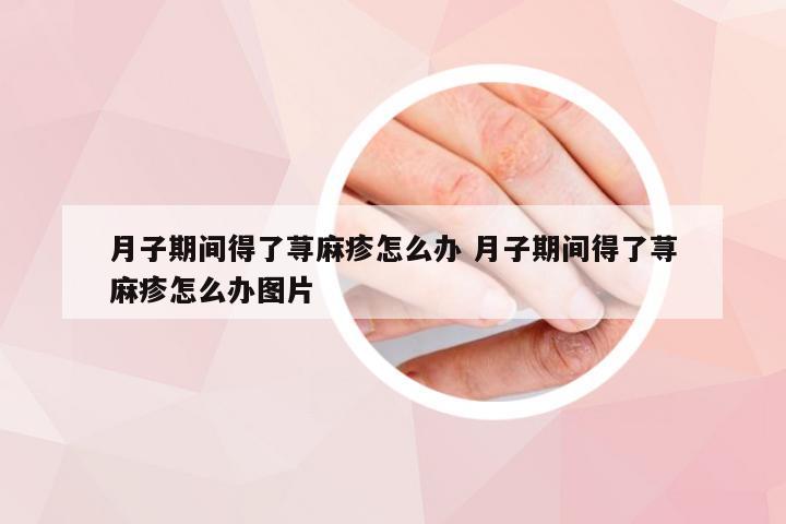 月子期间得了荨麻疹怎么办 月子期间得了荨麻疹怎么办图片