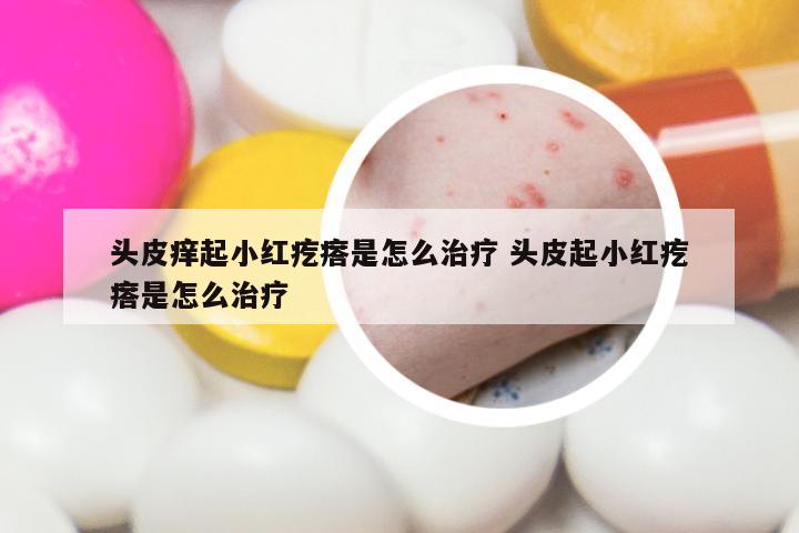 头皮痒起小红疙瘩是怎么治疗 头皮起小红疙瘩是怎么治疗