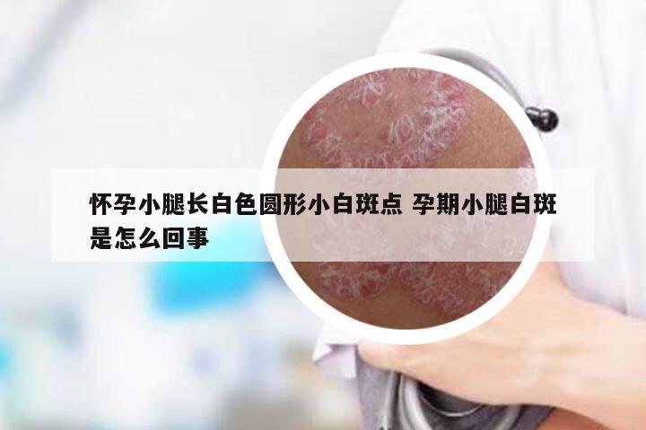 怀孕小腿长白色圆形小白斑点 孕期小腿白斑是怎么回事