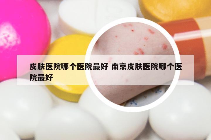 皮肤医院哪个医院最好 南京皮肤医院哪个医院最好