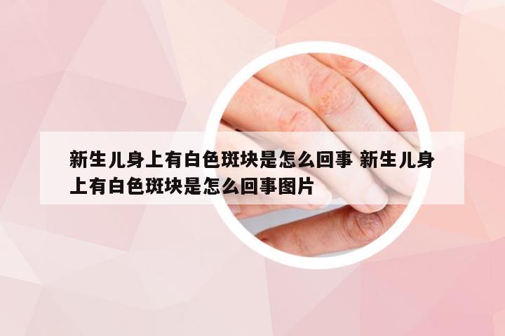 新生儿身上有白色斑块是怎么回事 新生儿身上有白色斑块是怎么回事图片