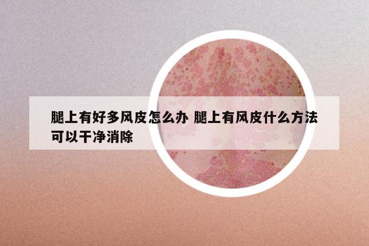 腿上有好多风皮怎么办 腿上有风皮什么方法可以干净消除