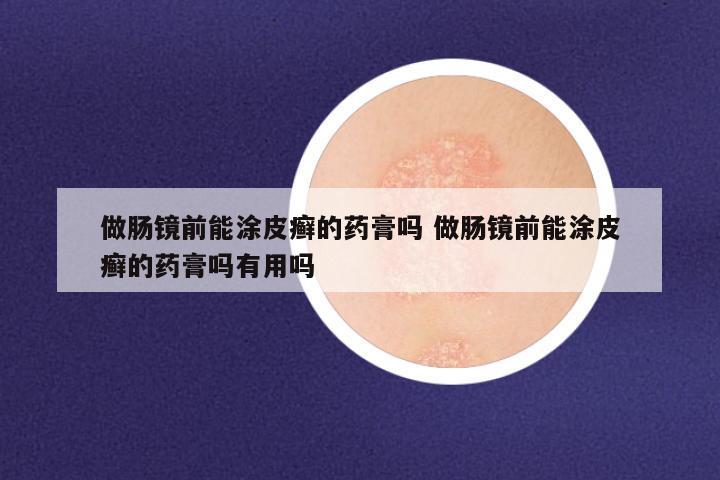 做肠镜前能涂皮癣的药膏吗 做肠镜前能涂皮癣的药膏吗有用吗