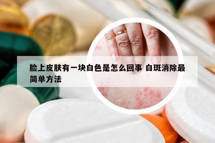 脸上皮肤有一块白色是怎么回事 白斑消除最简单方法