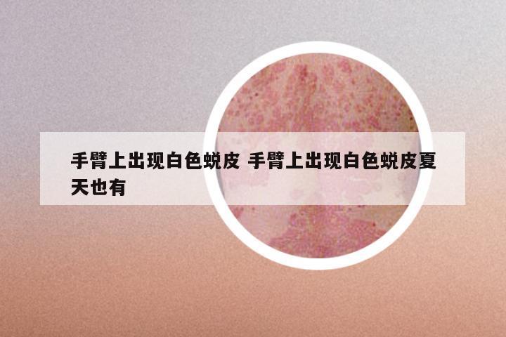 手臂上出现白色蜕皮 手臂上出现白色蜕皮夏天也有
