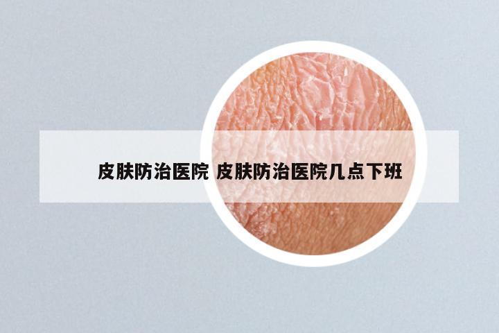皮肤防治医院 皮肤防治医院几点下班