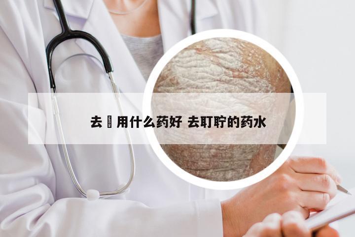 去廯用什么药好 去耵聍的药水