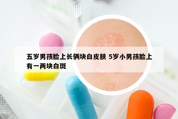 五岁男孩脸上长俩块白皮肤 5岁小男孩脸上有一两块白斑