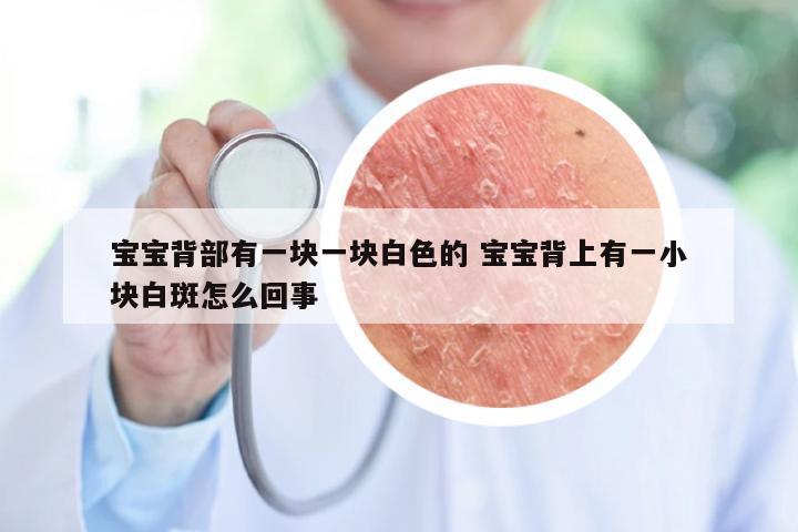 宝宝背部有一块一块白色的 宝宝背上有一小块白斑怎么回事