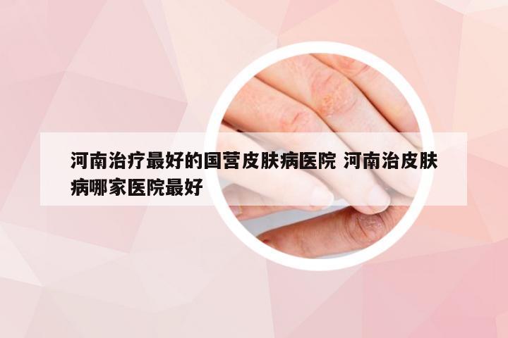 河南治疗最好的国营皮肤病医院 河南治皮肤病哪家医院最好