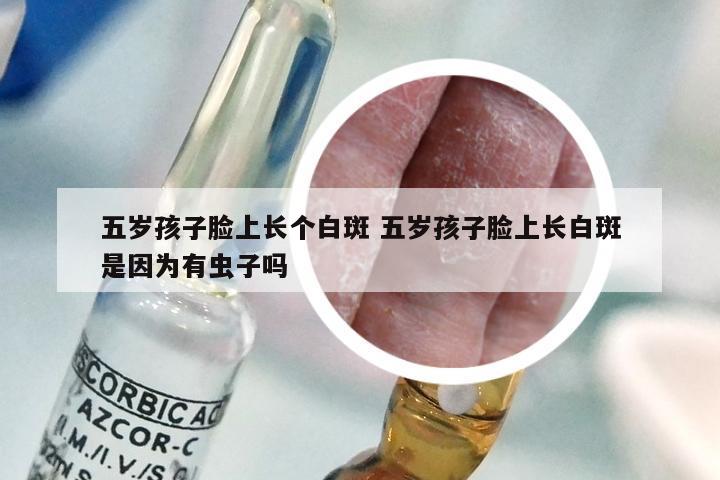五岁孩子脸上长个白斑 五岁孩子脸上长白斑是因为有虫子吗