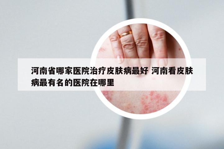 河南省哪家医院治疗皮肤病最好 河南看皮肤病最有名的医院在哪里