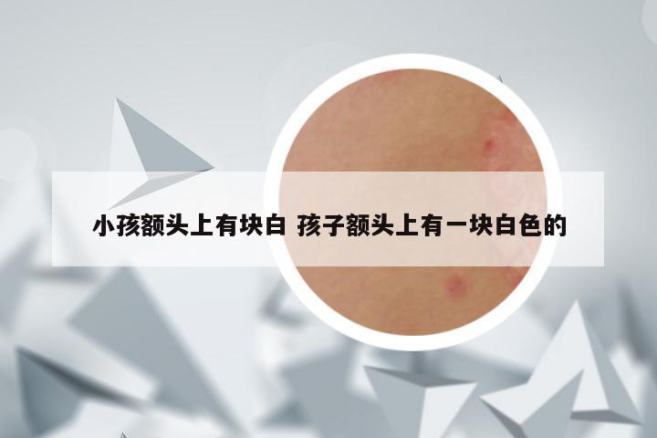 小孩额头上有块白 孩子额头上有一块白色的