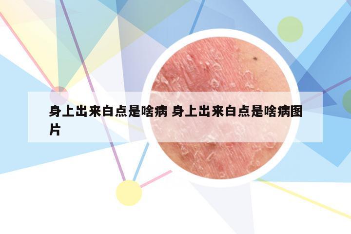 身上出来白点是啥病 身上出来白点是啥病图片
