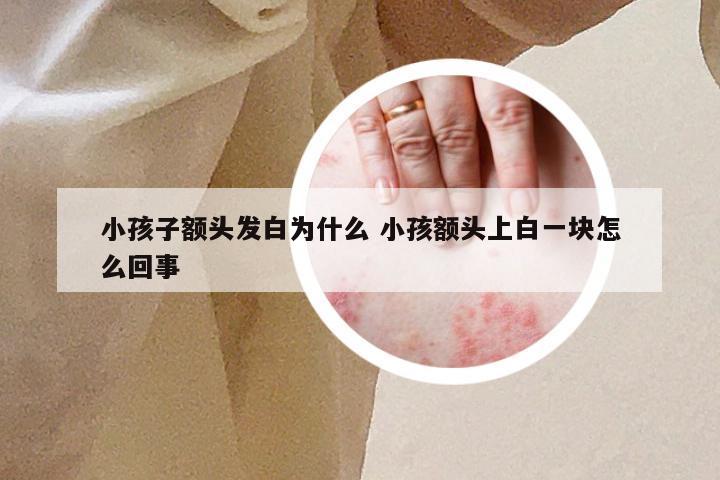 小孩子额头发白为什么 小孩额头上白一块怎么回事