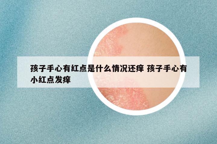孩子手心有红点是什么情况还痒 孩子手心有小红点发痒