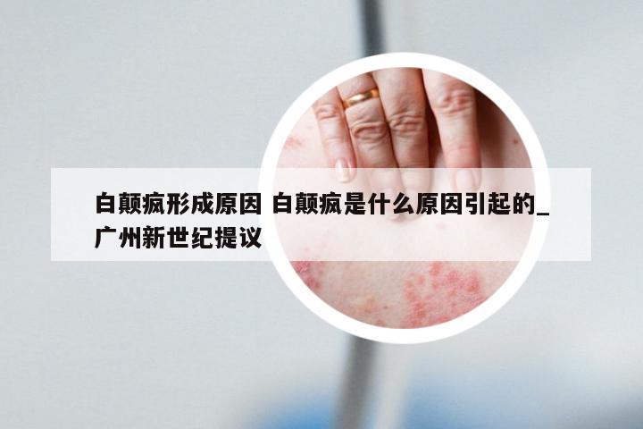 白颠疯形成原因 白颠疯是什么原因引起的_广州新世纪提议