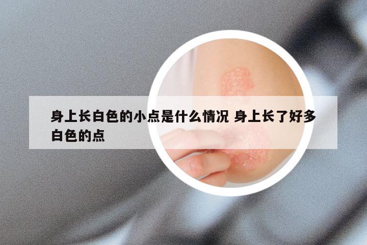 身上长白色的小点是什么情况 身上长了好多白色的点