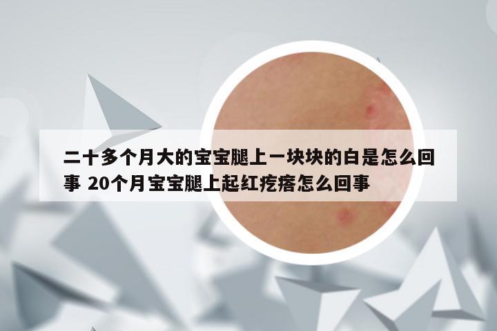 二十多个月大的宝宝腿上一块块的白是怎么回事 20个月宝宝腿上起红疙瘩怎么回事