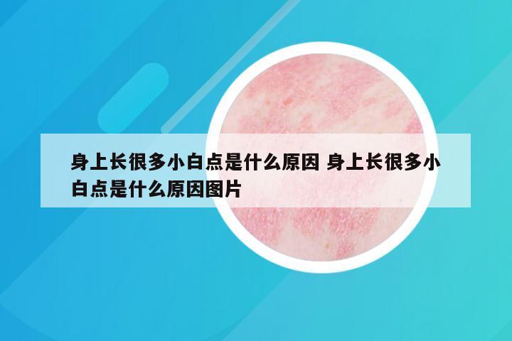 身上长很多小白点是什么原因 身上长很多小白点是什么原因图片