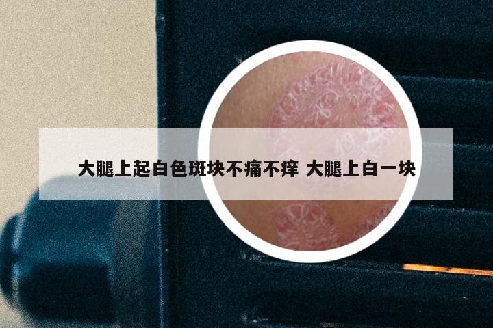 大腿上起白色斑块不痛不痒 大腿上白一块