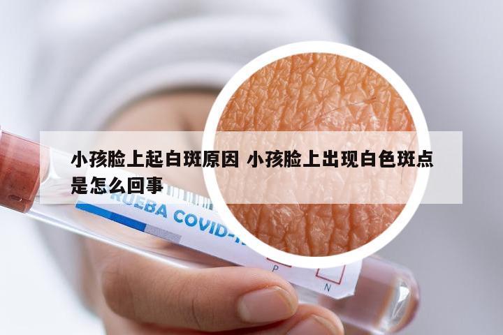 小孩脸上起白斑原因 小孩脸上出现白色斑点是怎么回事