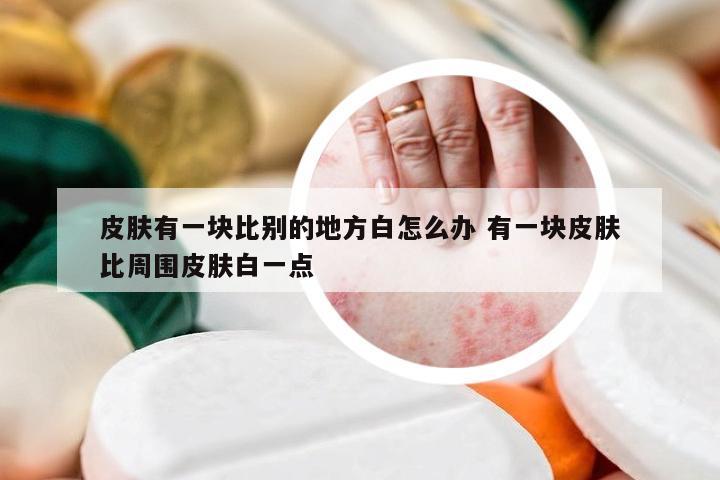 皮肤有一块比别的地方白怎么办 有一块皮肤比周围皮肤白一点