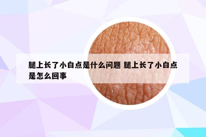 腿上长了小白点是什么问题 腿上长了小白点是怎么回事